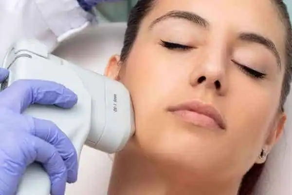 Image of woman having HIFU Luton treatment