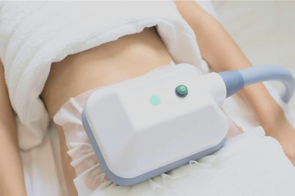 How Fat Freezing and HIFU Work Together? 3 advantages to combining Fat Freezing and HIFU Luton