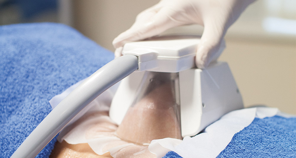 How Fat Freezing and HIFU Work Together? 2 Multiple Areas in One Session HIFU and Fat Freezing Luton