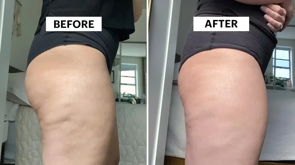 Sculpting Your Bum: Can Toning Exercises Really Reduce Cellulite? 1 Do Toning Exercise Luton Really Tackle Cellulite?