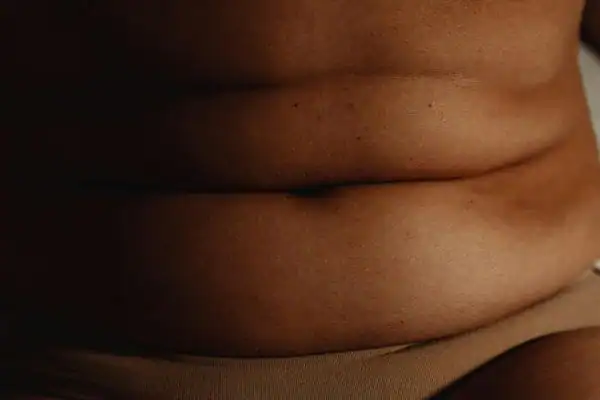 The Hidden Connection: How Stress Shapes Your Fitness and Body Composition 3 image of what stress can do on the stomach area and how Lipo 360 Luton can help to change your body shape.