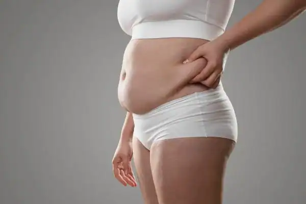 Image of stress belly Luton How Lipo 360 can help manage your symptoms