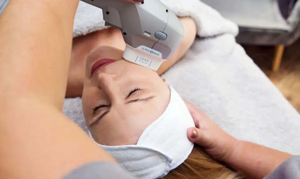 Discover the Perfect Duo: Morpheus8 and HIFU 1 Image of Morpheus8 And HIFU Luton combined treatment